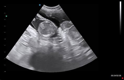 When Can A Pregnant Dog Have An Ultrasound