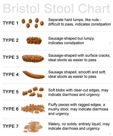 Top Bristol Stool Chart Reference Of All Time Check It Out Now Stoolz