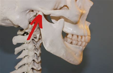 Tips To Identify And Treat Jaw Disorders Zen Physiotherapy