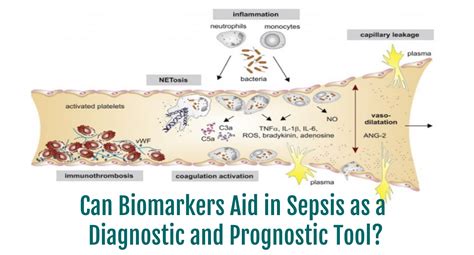 Can Biomarkers Aid In Sepsis As A Diagnostic And Prognostic Tool
