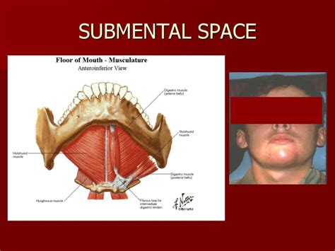 Surgical Fascial Spaces Online Presentation