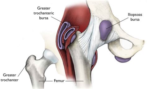 Trochanter Definition Greater And Lesser Trochanter Pain And Fracture