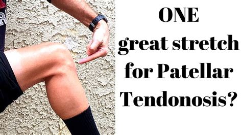 One Perfect Stretch For Patellar Tendonosis Youtube