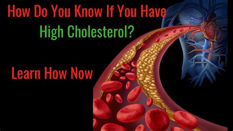 Signs And Symptoms Of High Cholesterol In The Body High Cholesterol