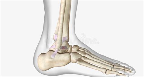 Lateral Ankle Sprain Torn Anterior Talofibular Ligament Stock