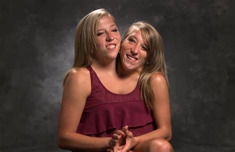the conjoined twins who just turned 27 years old have made an important life decision