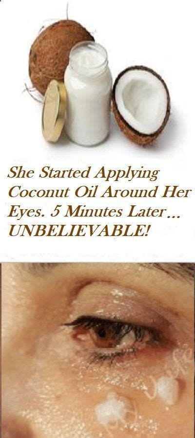 She Started Applying Coconut Oil Around Her Eyes Apply Coconut Oil