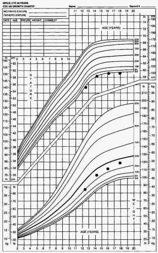 Short Stature And Growth Hormone Therapy Obgyn Key