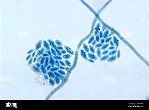 Microfotografía De Los Conidióforos Con Conidias Del Hongo Cladosporium