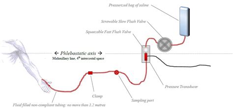 Know Your A Lines Part 2 Sinaiem