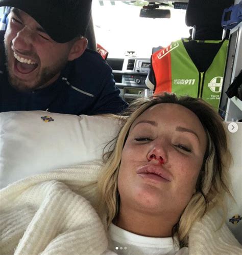 Charlotte Crosby Rushed To Hospital With A Broken Nose After Horror