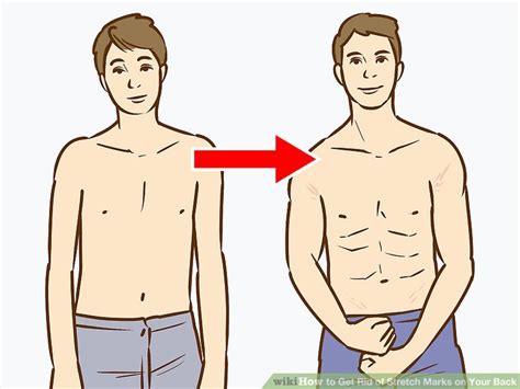 3 Ways To Get Rid Of Stretch Marks On Your Back Wikihow