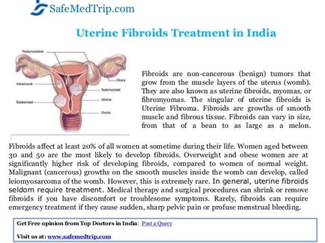 No Surgery And Quick Recovery Nonsurgical Uterine Fibroid Treatment At