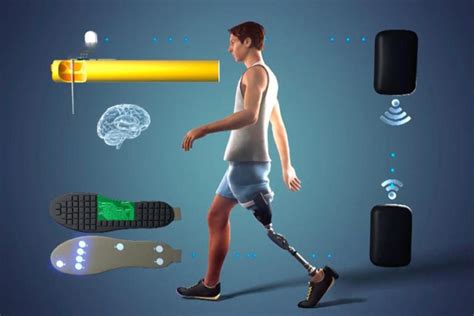 New Prosthetic Leg With Bionic Feeling Improves Amputees Health