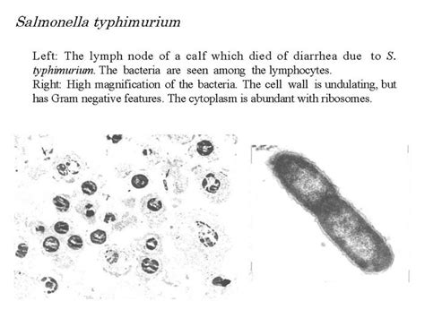 Salmonella Under Microscope My XXX Hot Girl