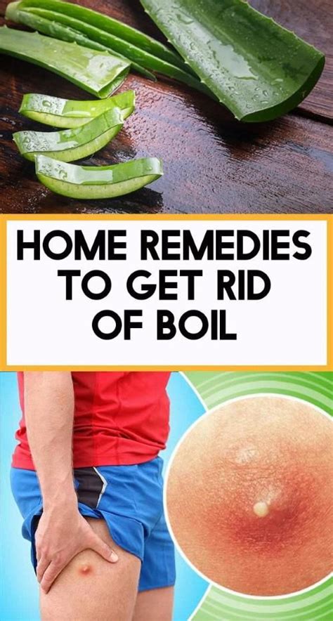 Home Remedies To Get Rid Of Boil Home Remedies Remedies Get Rid