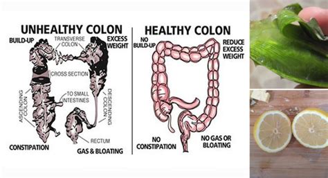 Best Foods For Colon Cleansing Natural Solutions Magazine Dedicated To Teach People How To