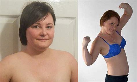 Catherine Keeney Who Had A DOUBLE Mastectomy Bares Her Scars In