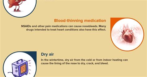 What Causes Nosebleeds Infographic