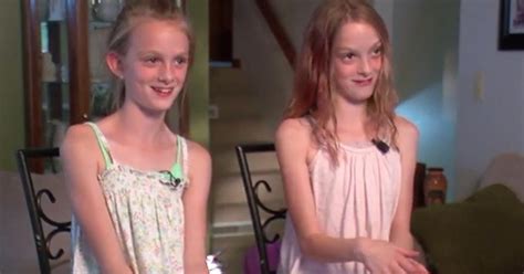 North Dakota Conjoined Twins Celebrate Years Apart Cbs News