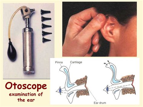 Ppt Otoscopy By Professor Dr Hassan Wahba Ear Nose And Throat