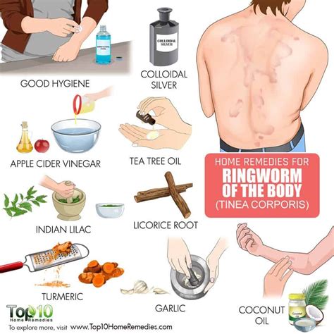 How To Get Rid Of Ringworm Of The Body Homeremediesforringworm Home