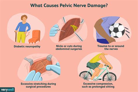 Nerve Damage Causes Symptoms And Complications Top Home Hot Sex Picture