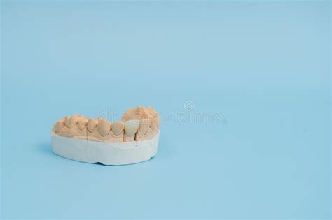 Study Model Of Teeth And Gums On Blue Background Stock Photo Image