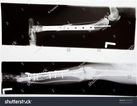 35 Top Photos Cat Broken Leg Surgery Joint Dislocation In Cats What
