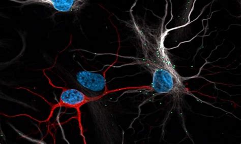 New Role Identified For Astrocytes In Brain Processing