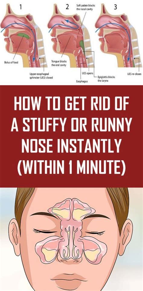 How To Get Rid Of A Stuffy Or Runny Nose Instantly Within 1 Minute