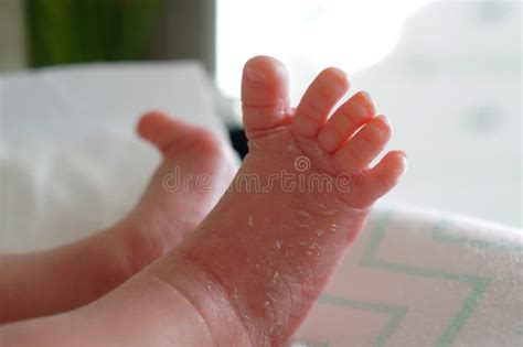 136 Newborn Skin Peeling Stock Photos Free And Royalty Free Stock