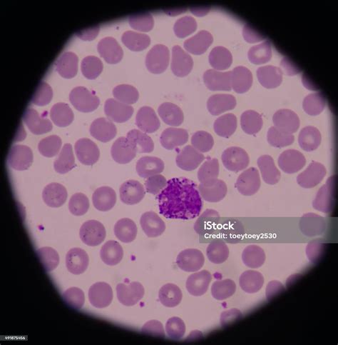 Basophil Granulocytes Stock Photo Download Image Now 2015 Acute