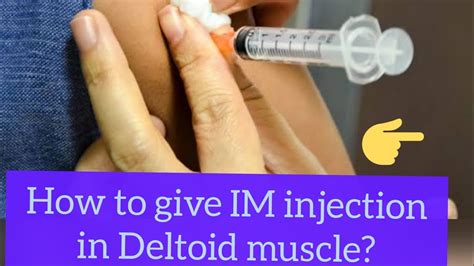 How To Give Im Injection In Deltoid Muscle Youtube