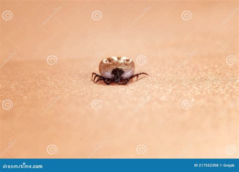 Enlarged Tick On Skin Stock Photo Image Of Mite Arachnid 217552308