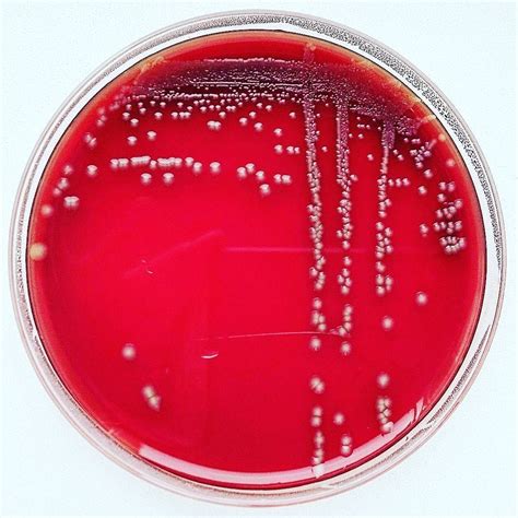 Pin Auf Microbiology By Antisocialmet