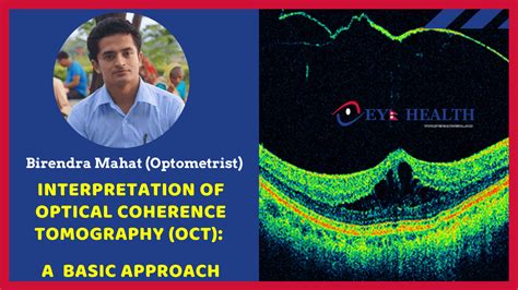 What Is Optical Coherence Tomography Oct Basic Interpretation