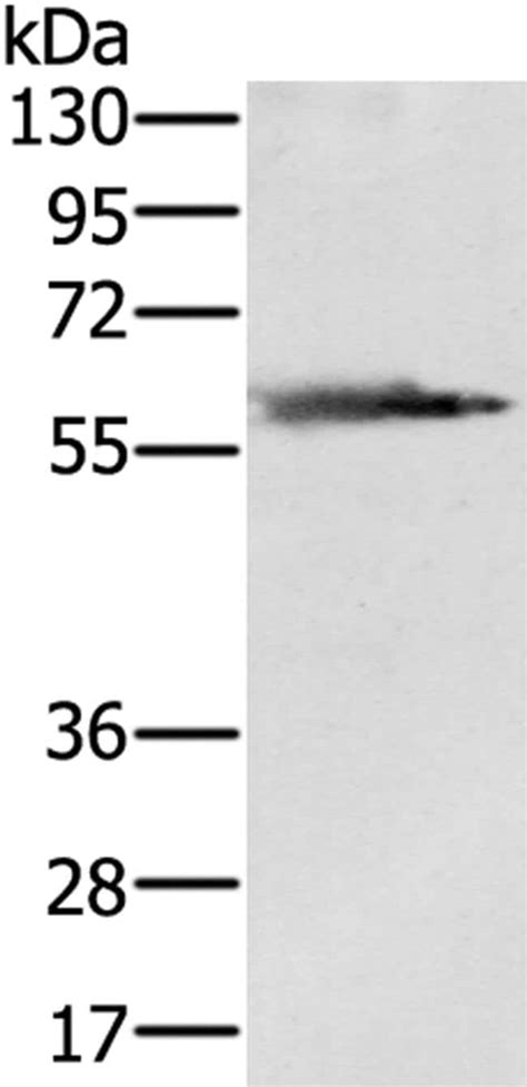 Pmat Antibody Pa5 50877