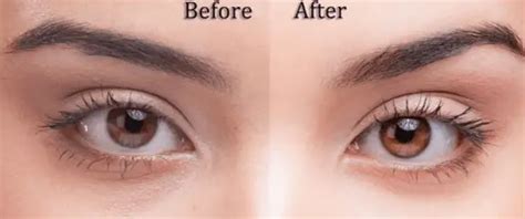 How To Change Your Eye Color Naturally Permanently With Honey Spell