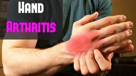 Fast Treatment For Hand Arthritis ~ Self Massage Youtube