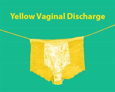 Yellow Vaginal Discharge Types Symptoms Causes 34960 The Best Porn Website