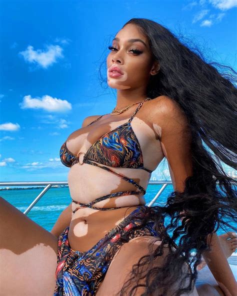 Winnie Harlow Shows Off New Bikini Trend 23 Photos The Fappening