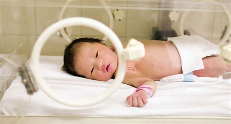 Common Conditions Treated In The Neonatal Intensive Care Unit Nicu
