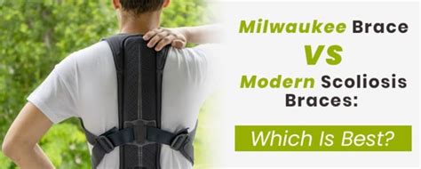 Milwaukee Brace Vs Modern Scoliosis Braces Which Is Best