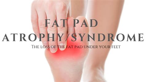 Fat Pads Atrophy Syndrome Well Heeled Podiatry In Hampton