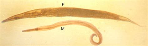 Enterobius Vermicularis Medical Laboratories