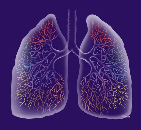 Npr Medicare Poised To Cover Ct Scans To Screen For Lung Cancer