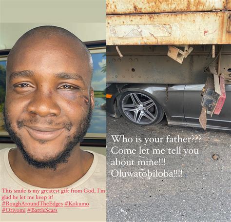 Someone Survived This Shock As Man Shares Testimony Of How He