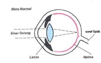 Informasi terapi mata minus berikut akan sangat mencerahkan anda. Kelompok Alat Indera Mata: MEKANISME KERJA