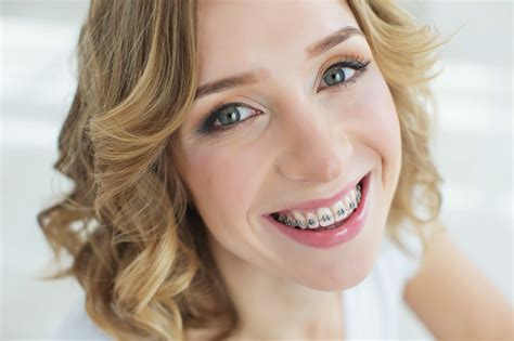 Big Benefits Of Braces In Your Adult Years Doyle Orthodontics